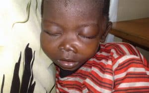 Africa AIDS pandemic