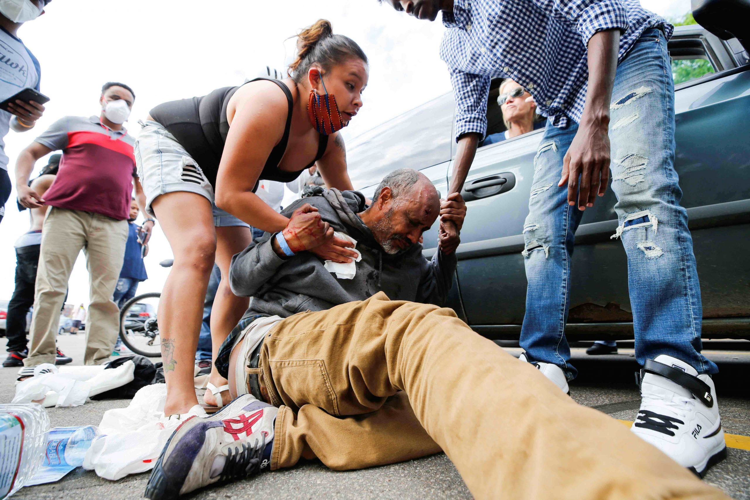 Un hombre es herido después de ser golpeado en la cabeza en una protesta en Minneapolis. Dos días antes, un agente de policía se arrodilló sobre el cuello de George Floyd, un hombre negro desarmado el 25 de mayo, 2020. (CNS/Eric Miller, Reuters)