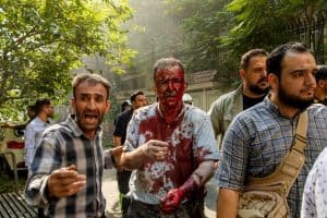 Un hombre herido reacciona tras los ataques aéreos israelíes en Teherán, Irán, el 15 de junio de 2025. Irán lanzó una nueva oleada de ataques con misiles contra Israel en la madrugada del 16 de junio, causando la muerte de al menos varias personas, mientras que Israel advirtió a los residentes de parte de Teherán que evacuaran la zona antes de nuevos ataques. (OSV News/amid Amlash, WANA (West Asia News Agency) vía Reuters)